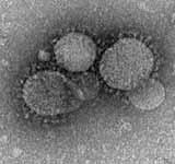 Middle East respiratory syndrome