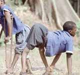 Polio