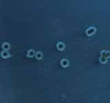 Salmonella enterica