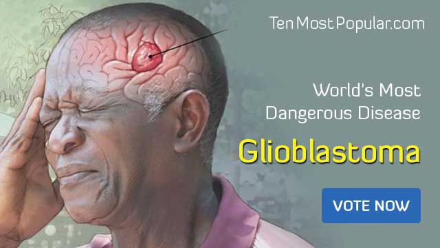 Glioblastoma