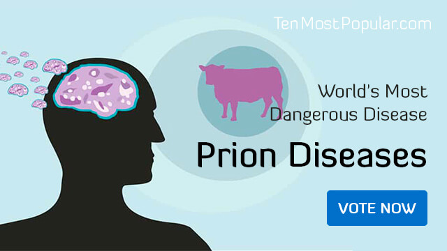 Prion Diseases