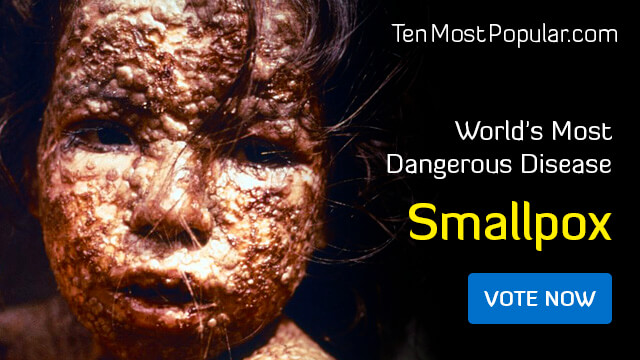 Smallpox